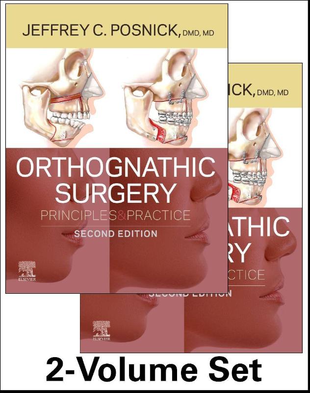 Orthognathic Surgery - 2 Volume Set