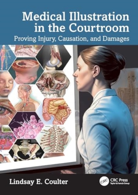 Medical Illustration in the Courtroom