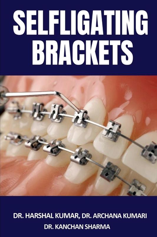 Selfligating Brackets