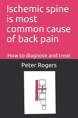 Ischemic Spine Is Most Common Cause of Back Pain: How to Diagnose and Treat