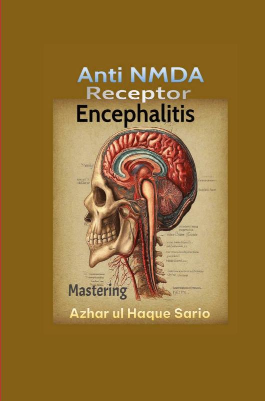Mastering Anti NMDA Receptor Encephalitis