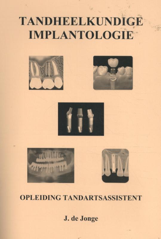 Tandheelkundige Implantologie
