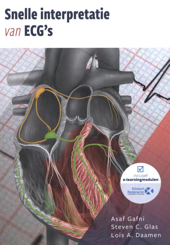 Snelle interpretatie van ECG’s