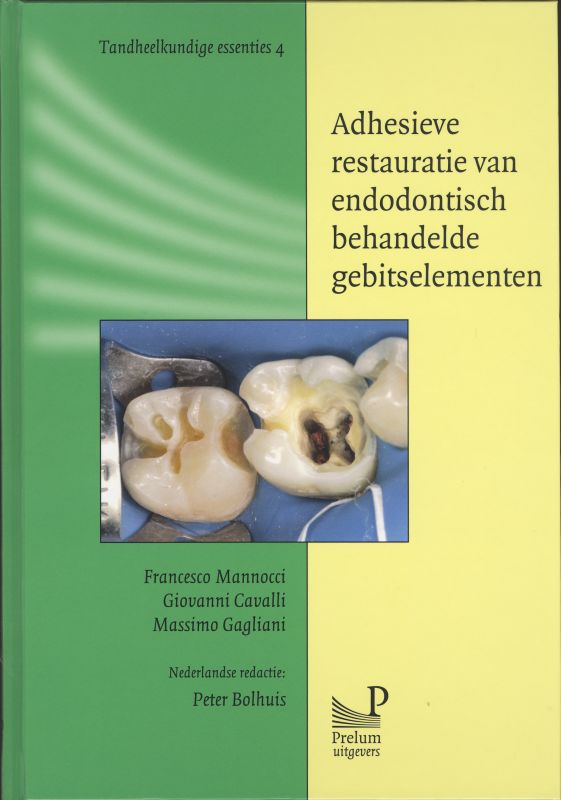 Adhesieve restauratie van endodontisch behandelde gebitselementen