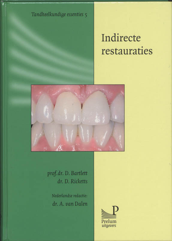 Indirecte restauraties