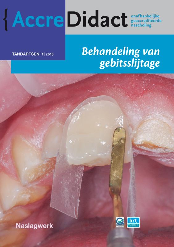 Behandeling van gebitsslijtage