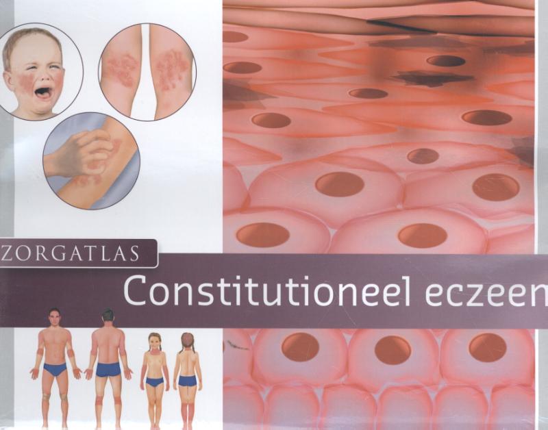 Zorgatlas constitutioneel eczeem