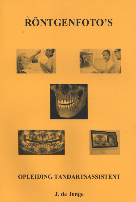 Röntgenfoto's