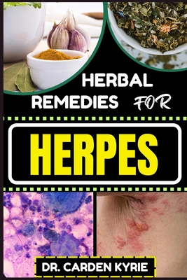 Herbal Remedies for Herpes: Unlocking Nature's Healing Power For Targeting Relief, Holistic Wellness, Immune Support And Integrating Herbs Into Yo
